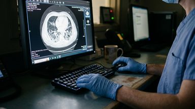 AL Amyloidosis Prognostic Models Lag Behind Treatment Advances