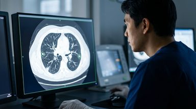Schizophrenia Spectrum Disorder Linked to Lower NSCLC Treatment Rates