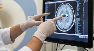 Familial Brain Pattern Similarity Links to Psychotic Disorder Risk in Offspring