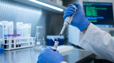 Immune Score Predicts Infection Risk in Multiple Myeloma