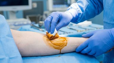 Iodine Antiseptics Safe for Patients With Documented Iodine Allergy Labels